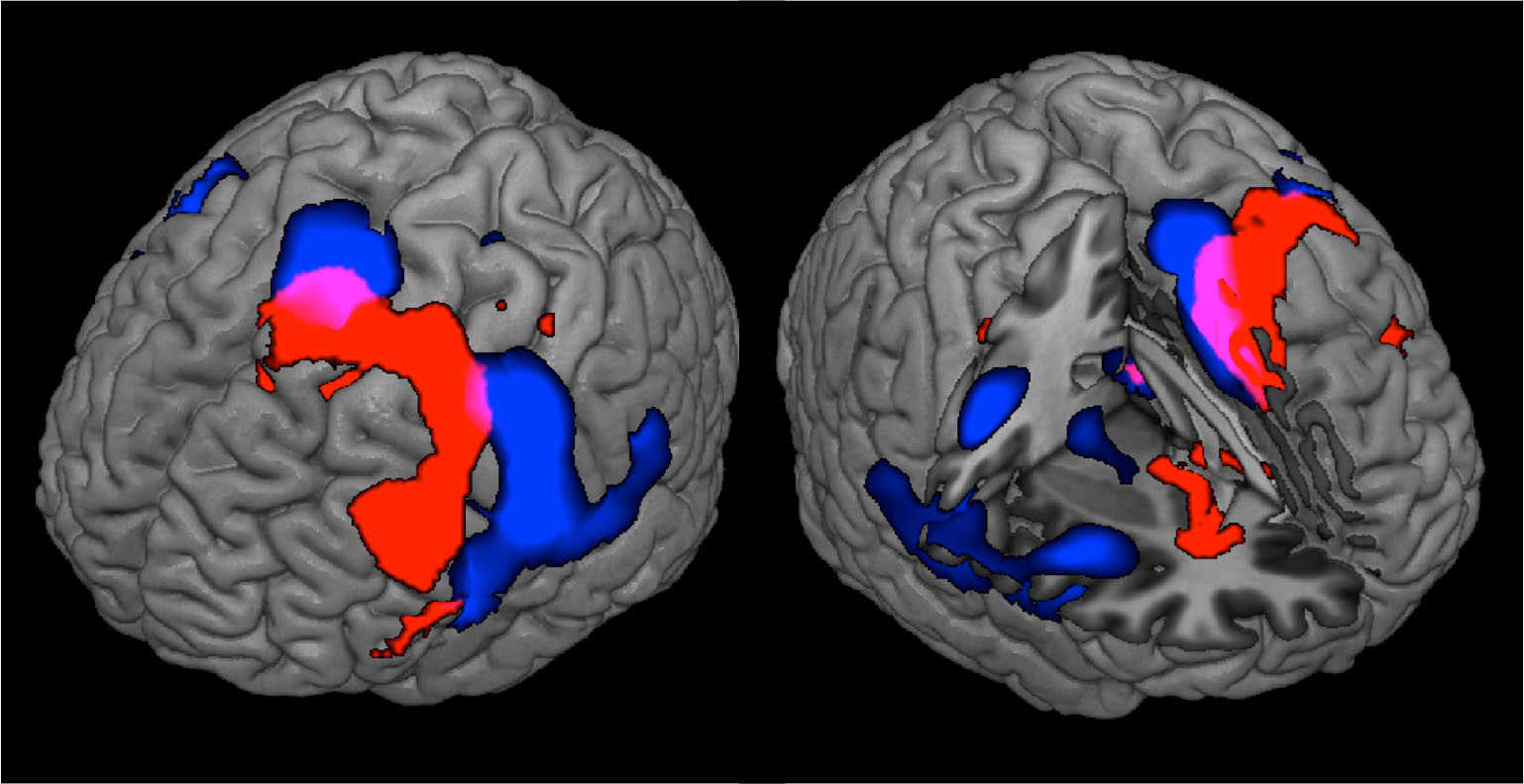 2. fmri