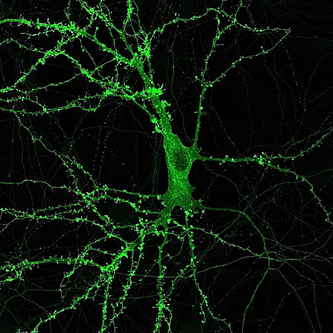 4. optogenetics